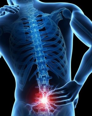 slipped disc relief in Charlotte NC